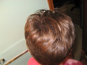 The Top/Back of My Head